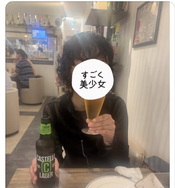 1年ケアを続けて回復した現在（アフター）