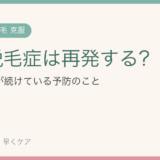 円形脱毛症は再発する？克服した私が”再発は警戒中”で続けている予防のこと【体験】